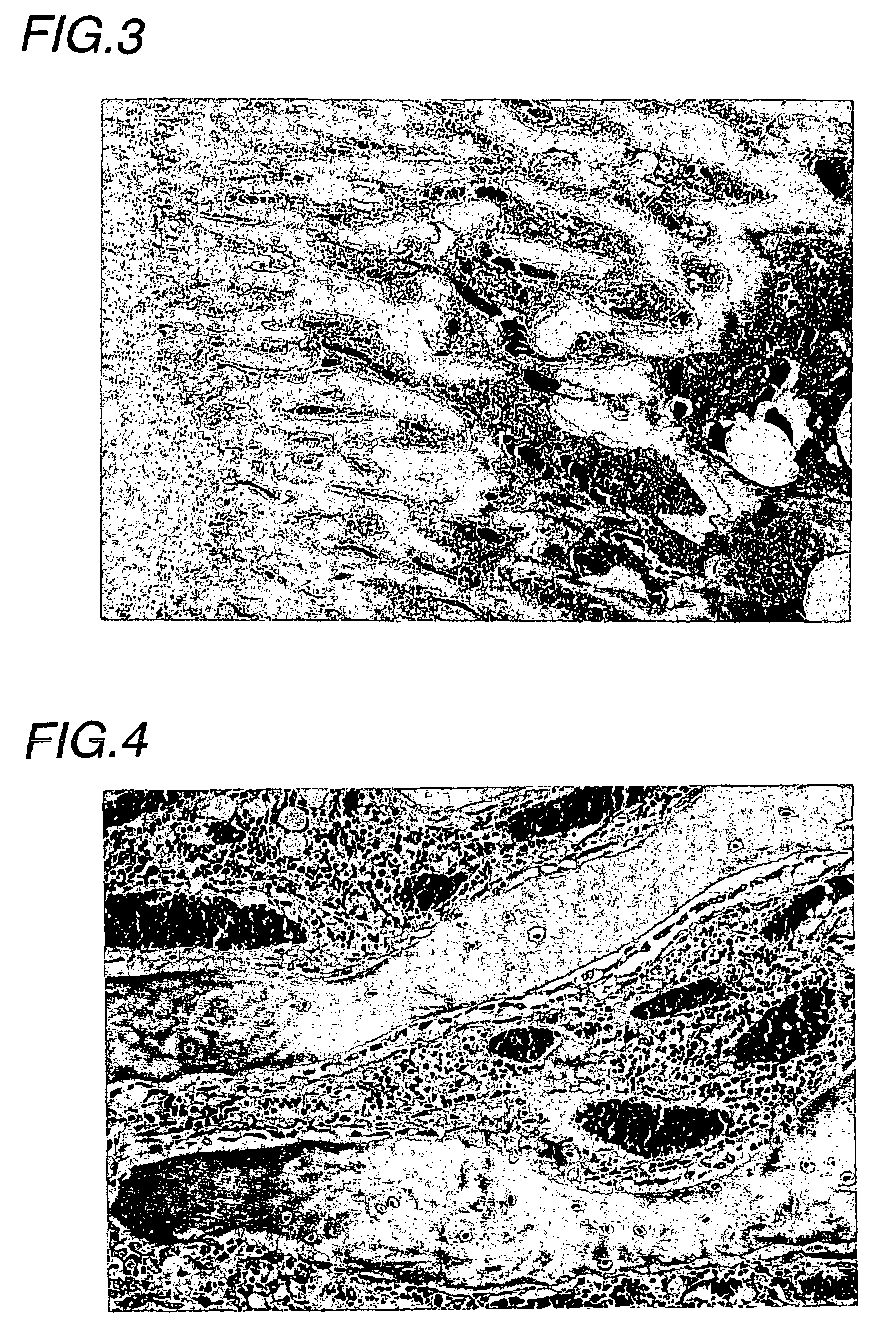 Agent for treatment of metabolic bone disease