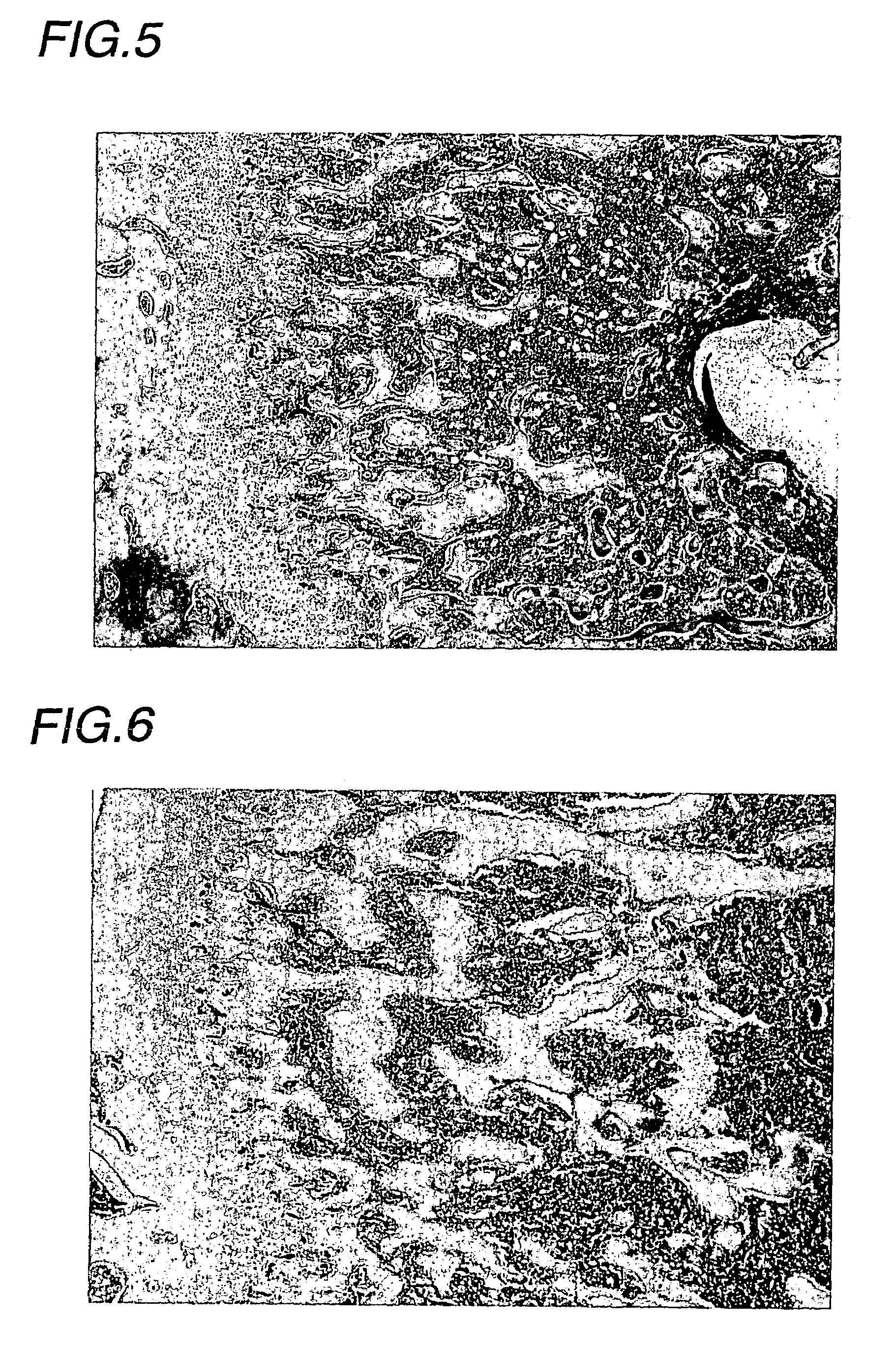 Agent for treatment of metabolic bone disease