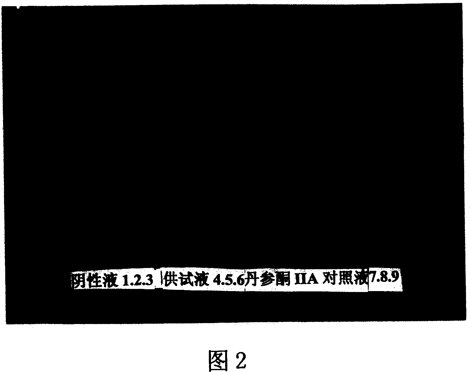 Composition of medicine for treating cerebral arteriosclerosis, and preparation method