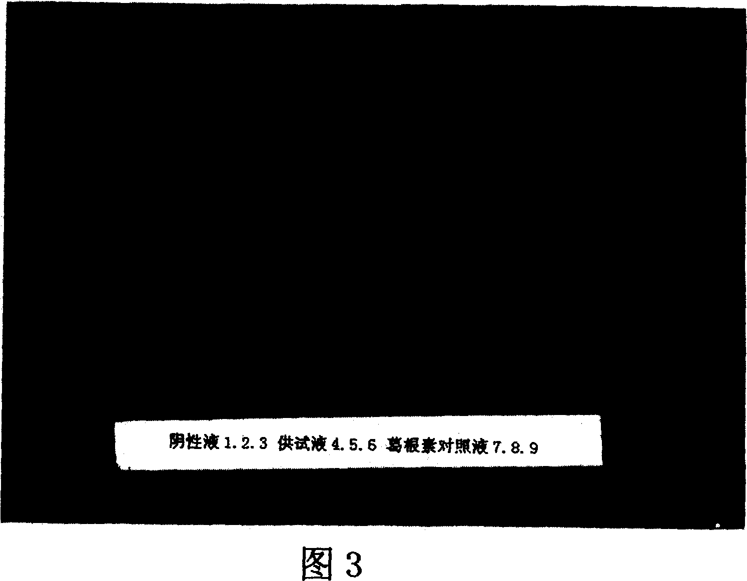 Composition of medicine for treating cerebral arteriosclerosis, and preparation method