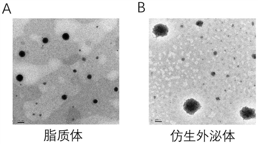 A kind of bionic exosome and its preparation and application