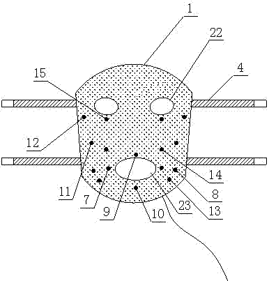 Intelligent evidence-based acupuncture diagnostic and therapeutic instrument for treating Bell palsy