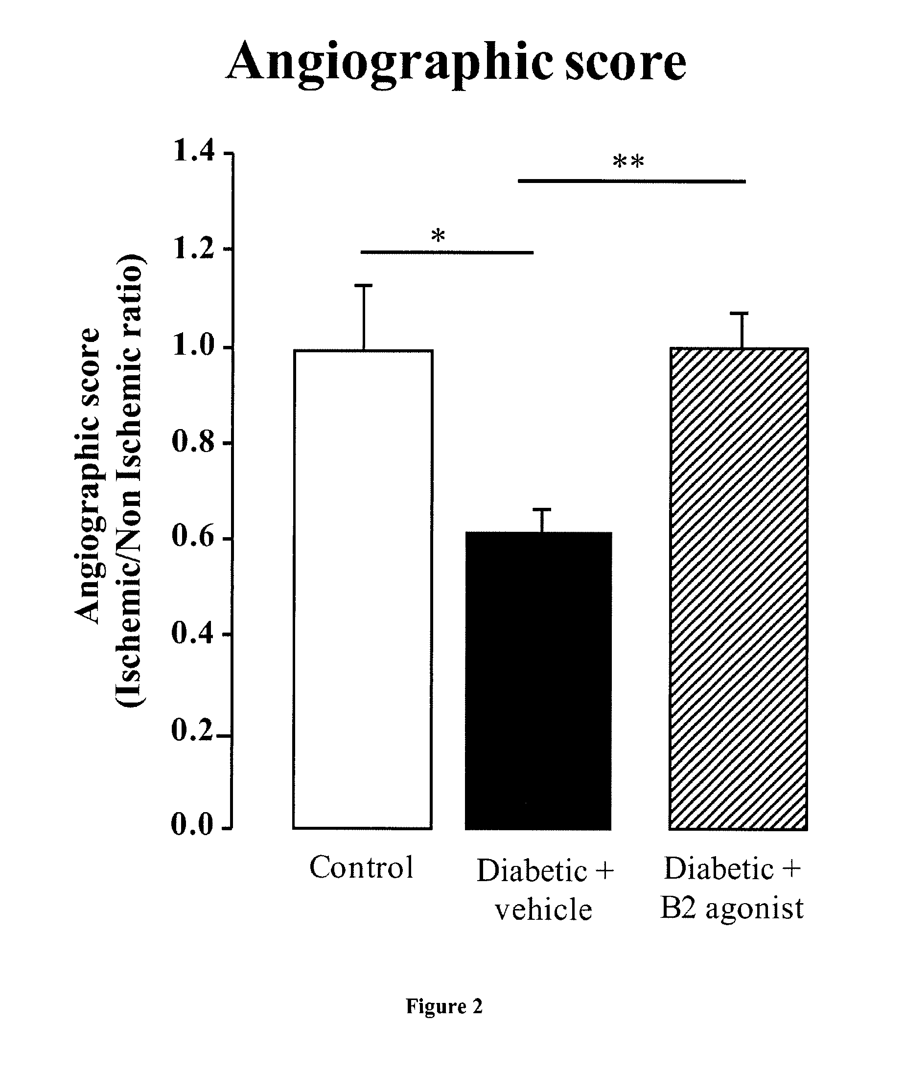 Methods and Pharmaceutical Compositions for Prevention or Treatment of Ischemia Related Organ Damage