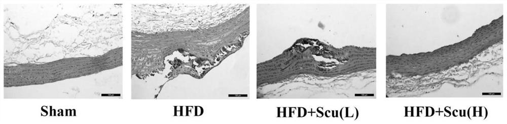 Application of scutellarin in preparation of medicine for preventing and treating atherosclerosis