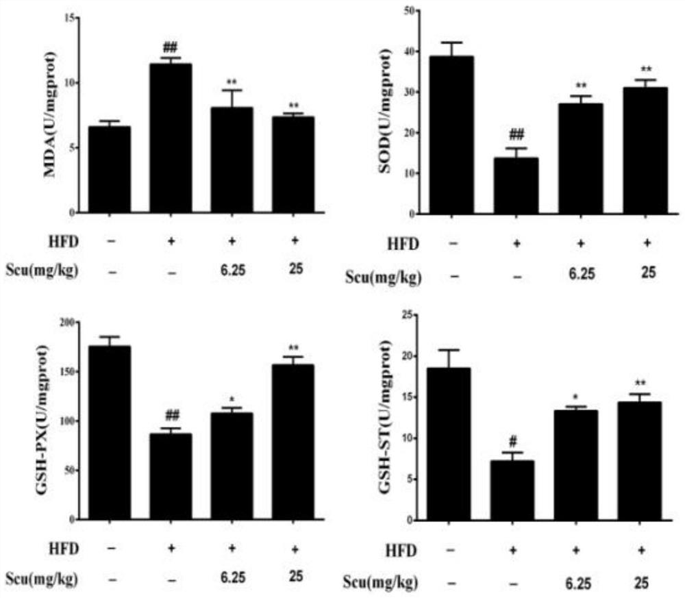 Application of scutellarin in preparation of medicine for preventing and treating atherosclerosis