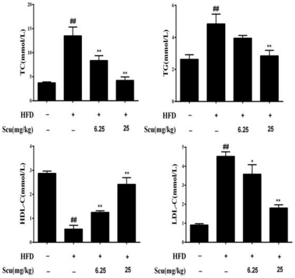 Application of scutellarin in preparation of medicine for preventing and treating atherosclerosis