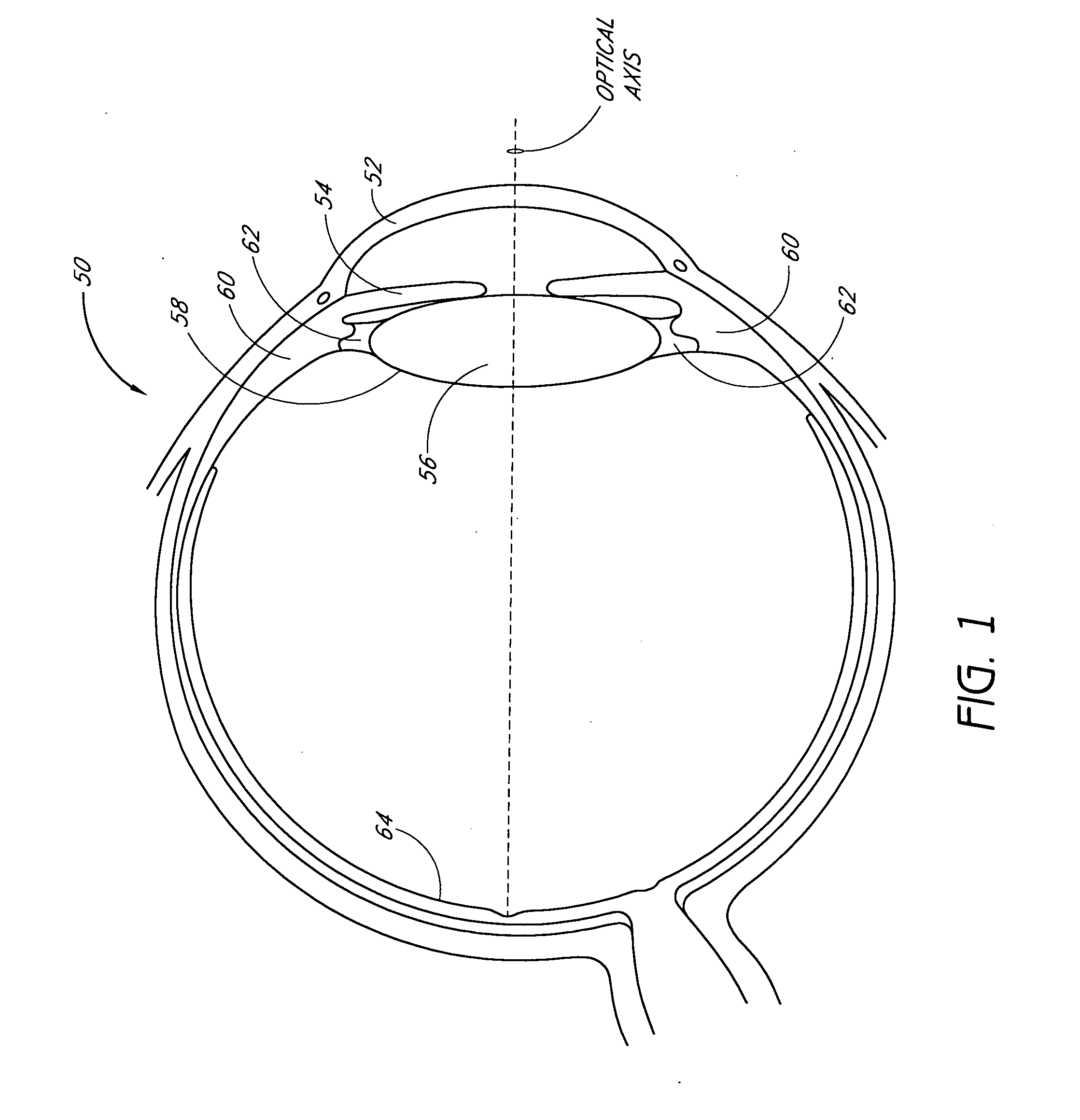 Accommodating diffractive intraocular lens