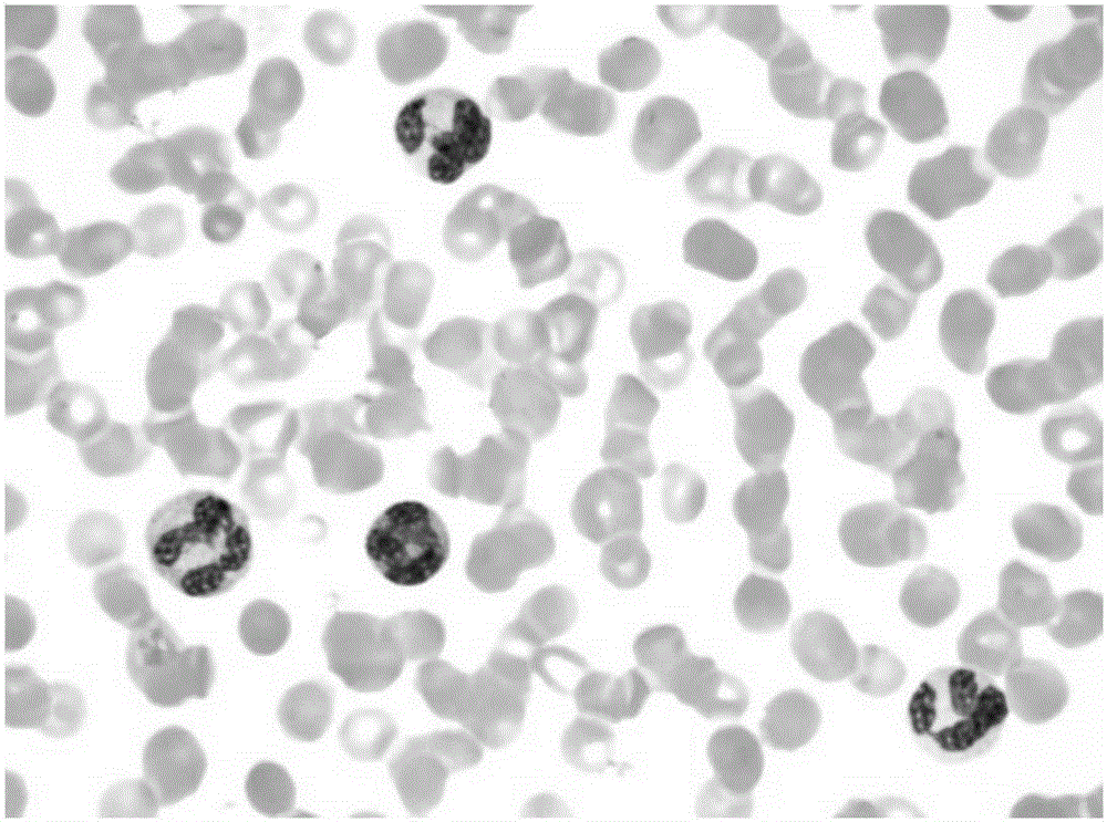 White blood cell segmentation method for color blood cell images based on superpixels and anomaly detection