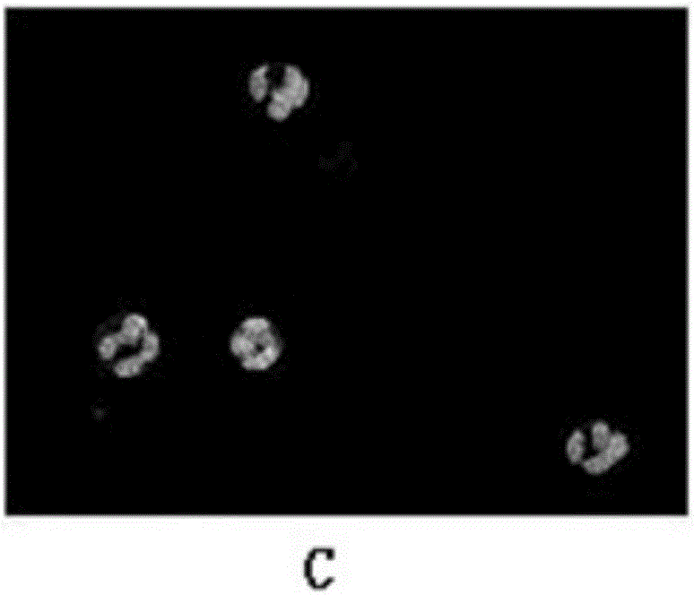 White blood cell segmentation method for color blood cell images based on superpixels and anomaly detection