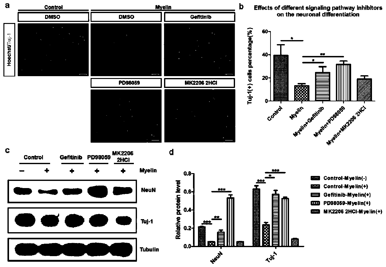 Application of EGFR/ERK/TRIM32 signal path in promoting differentiation of spinal nerve stem cells after spinal cord injury