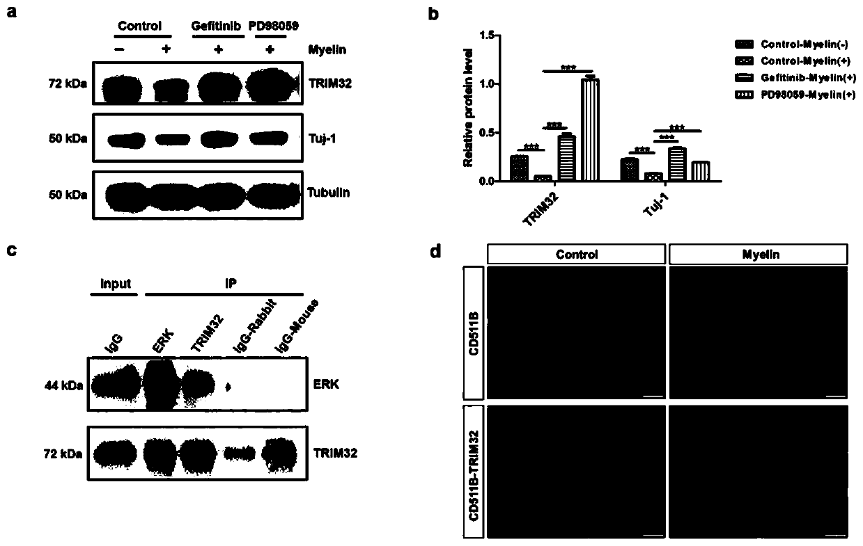 Application of EGFR/ERK/TRIM32 signal path in promoting differentiation of spinal nerve stem cells after spinal cord injury