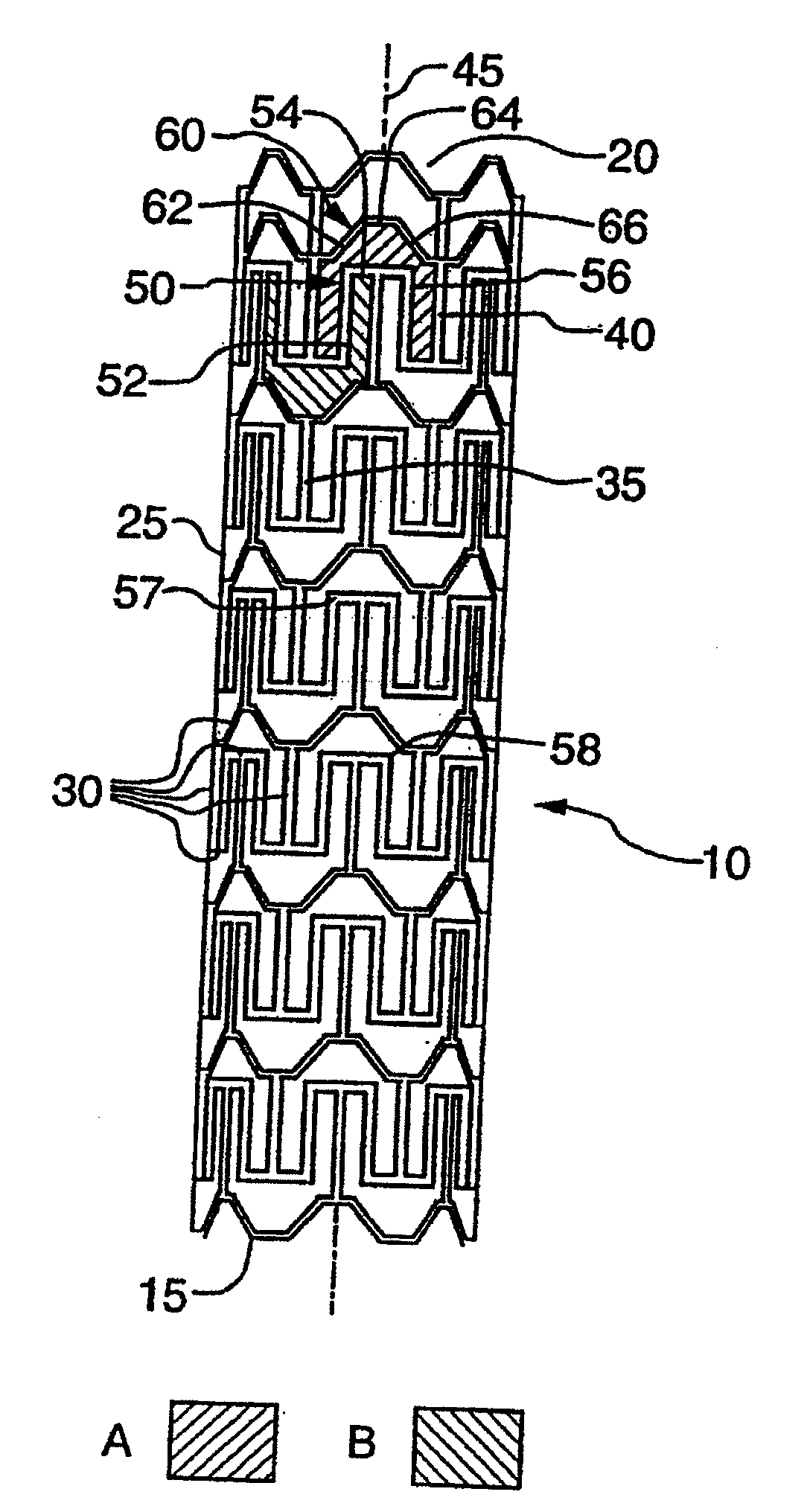 Expandable stent and method for delivery of same