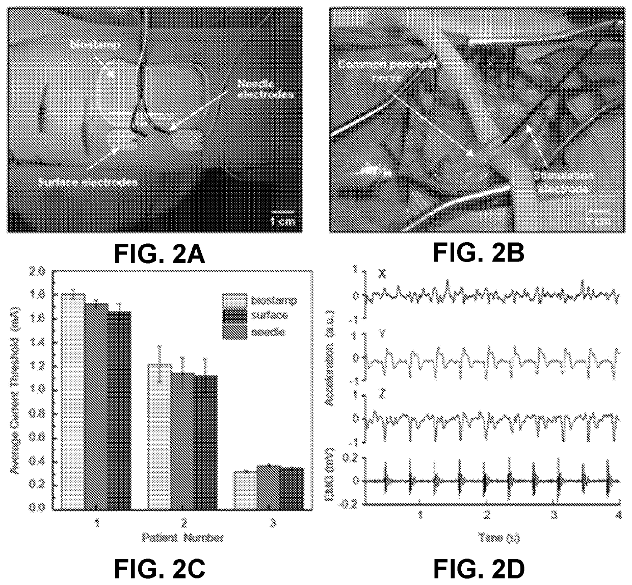 Intraoperative monitoring of neuromuscular function with soft, tissue-mounted wireless devices