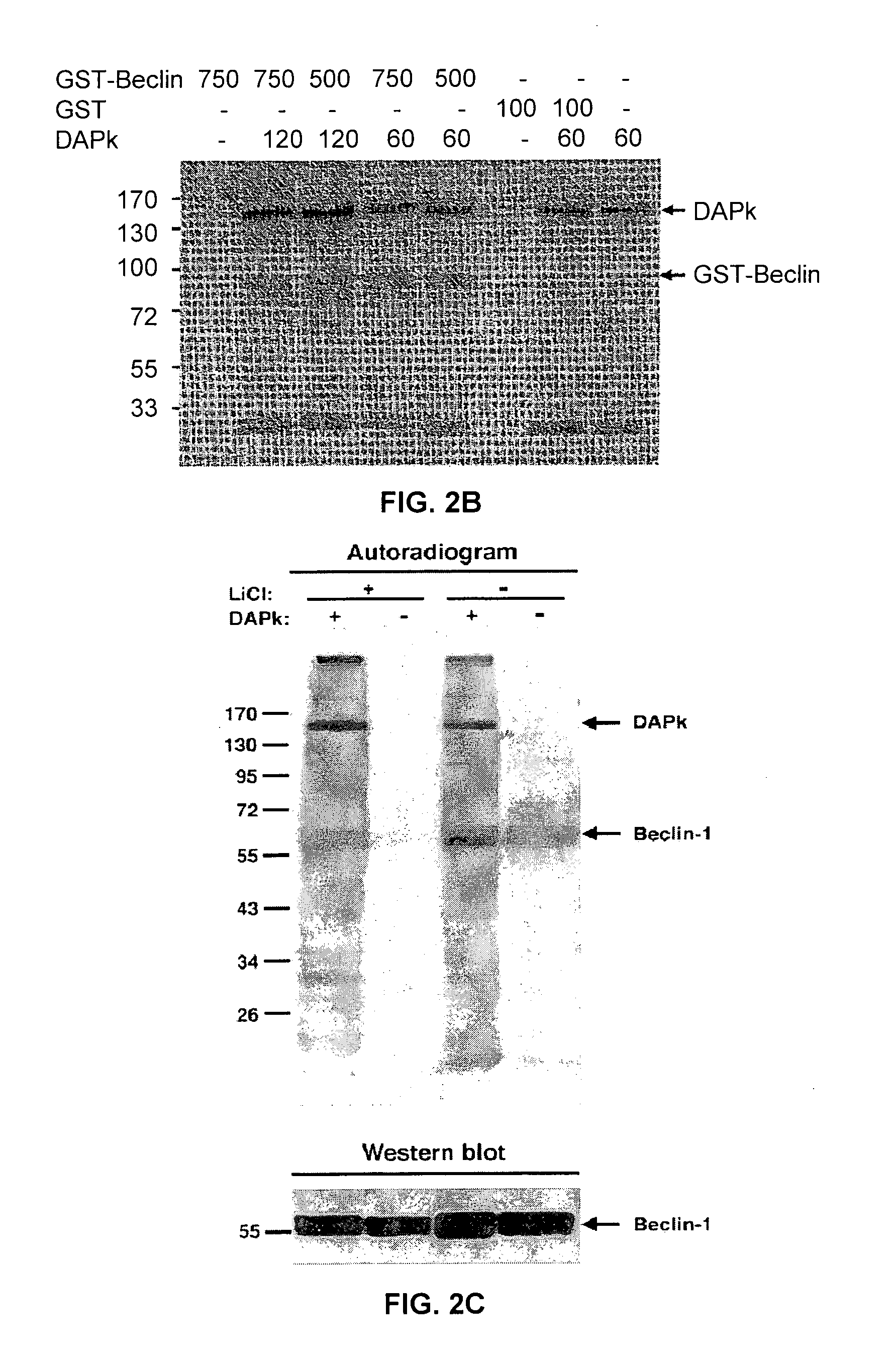 Compositions and methods for diagnosing and treating cancer and neurodegenerative diseases rlated to beclin-1