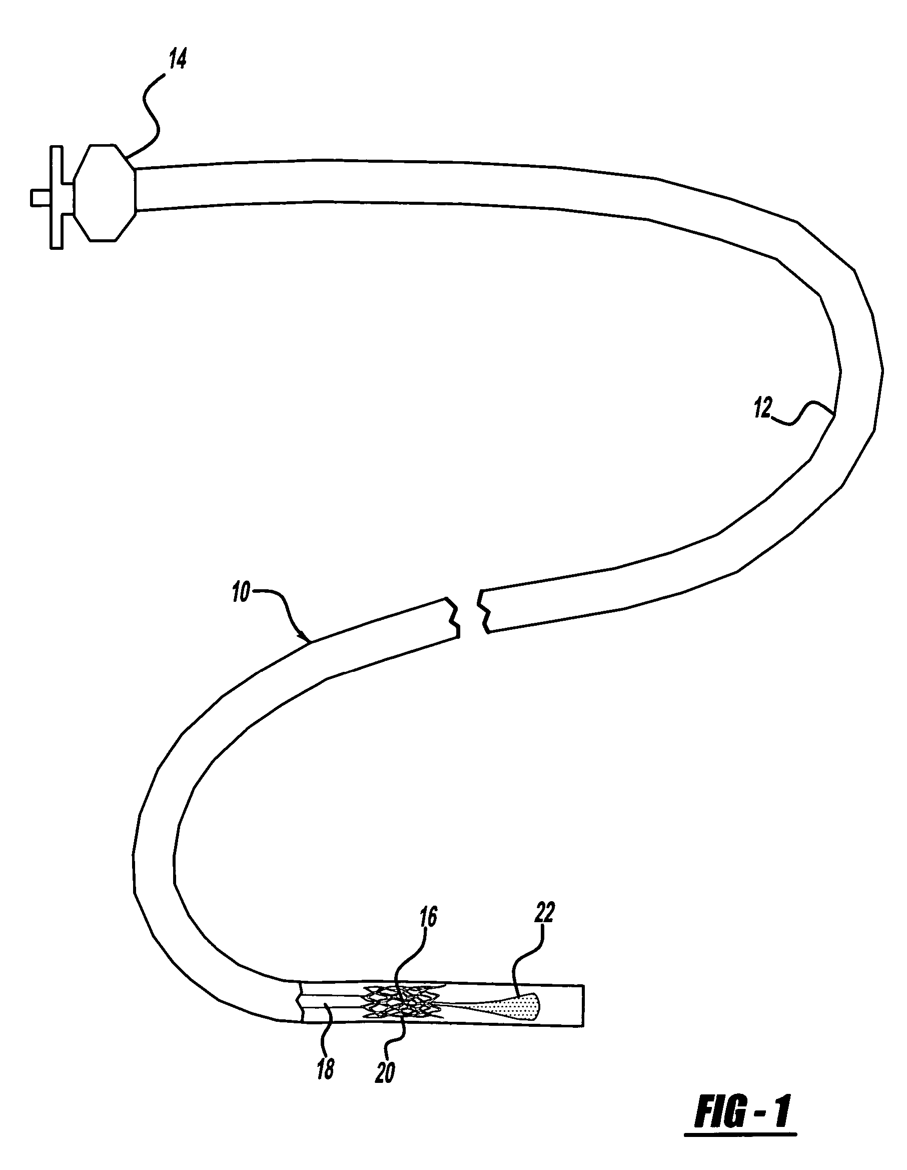 Neck covering device for an aneurysm