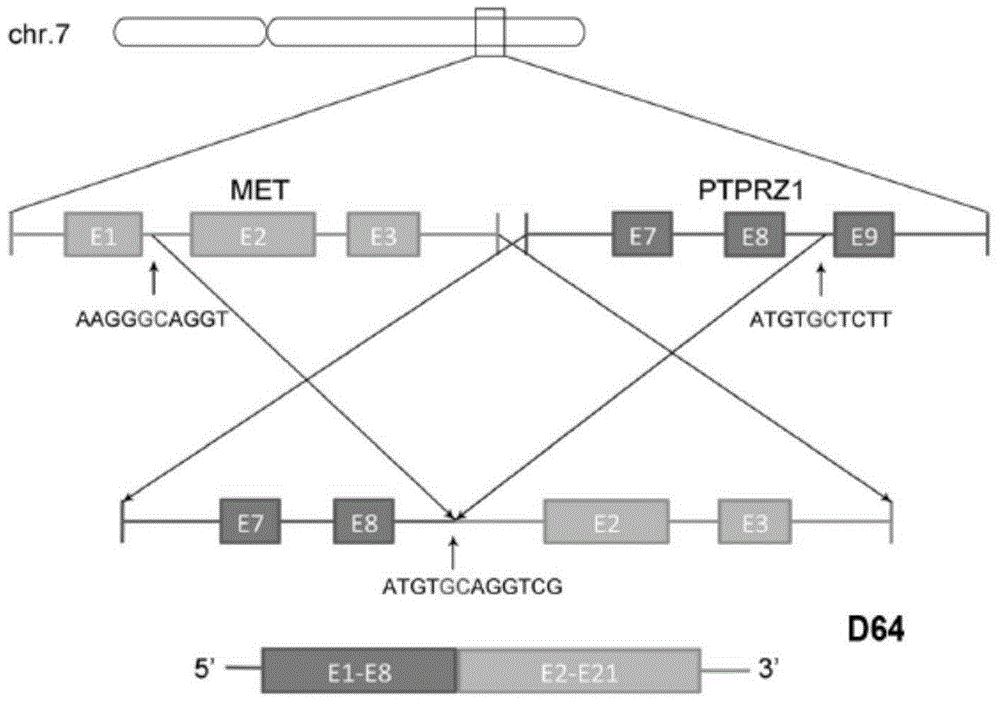 Fusion nucleic acid, fusion protein, and kit for detecting secondary glioblastoma