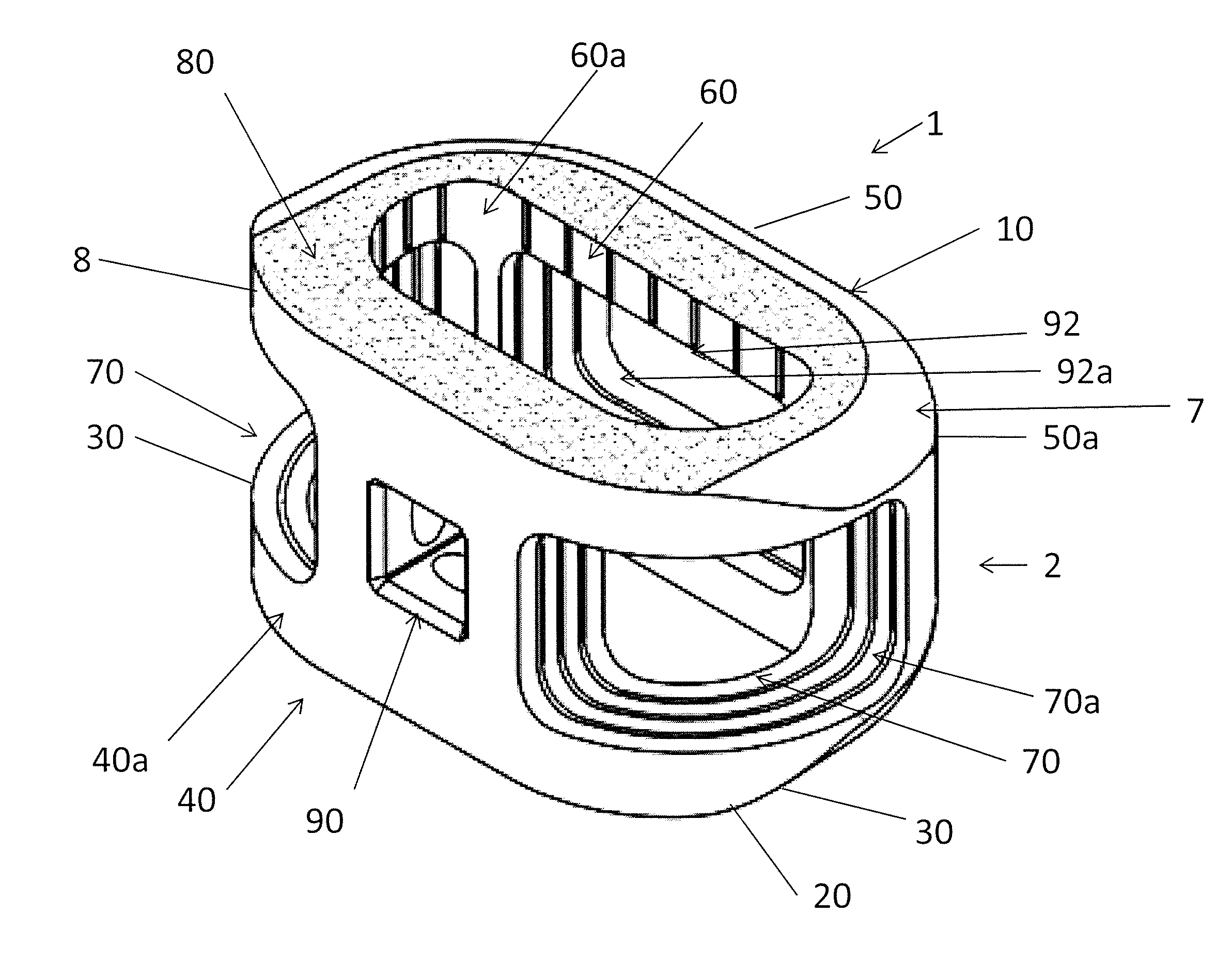 Process of fabricating implants having internal features for graft retention and load transfer between implant and vertebrae