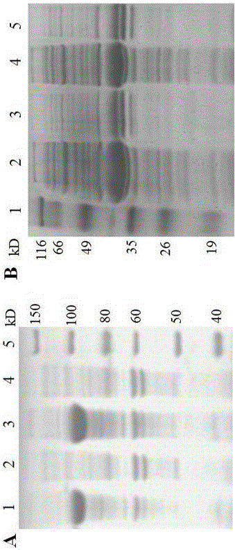 Human fibroblast growth factor 21 recombinant protein as well as preparation method and application thereof