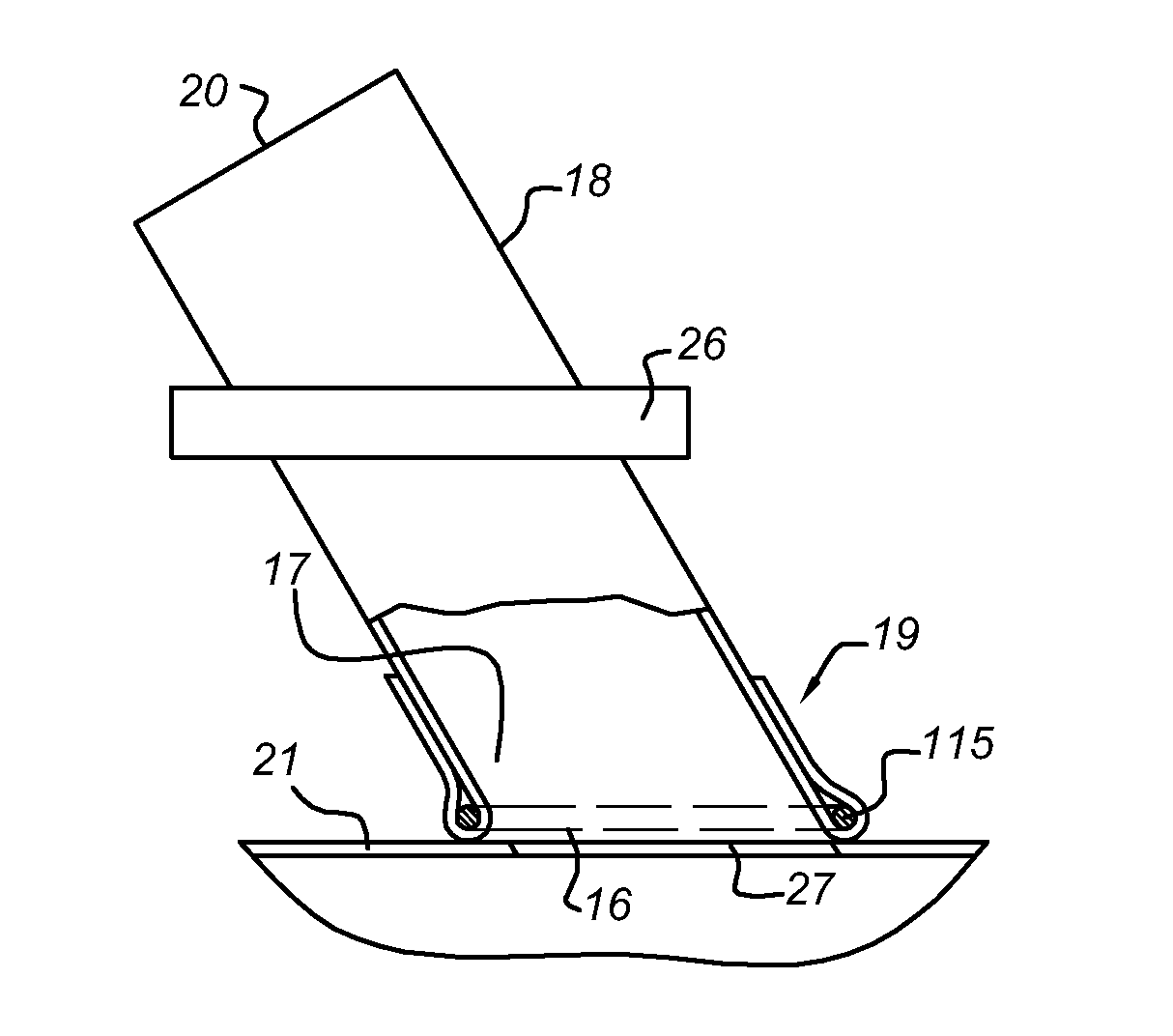 Laser catheter for bypass surgery and assembly comprising said catheter