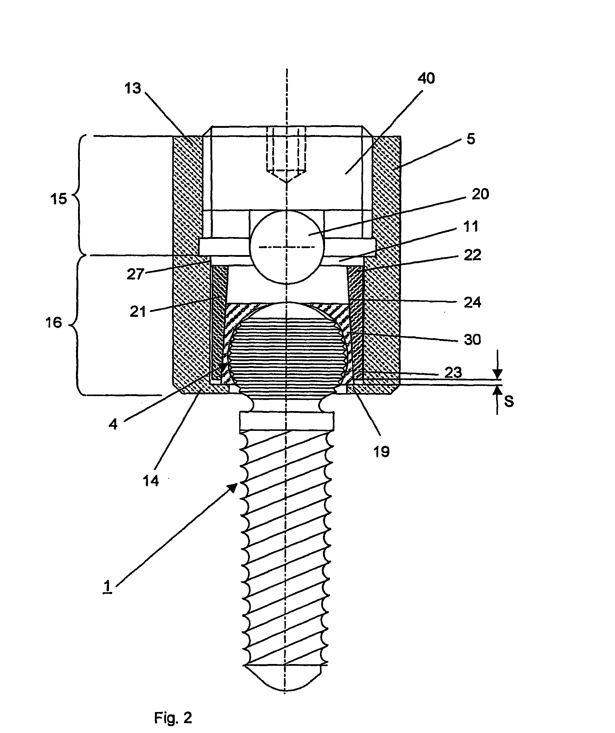 Device for the dynamic fixation of bones