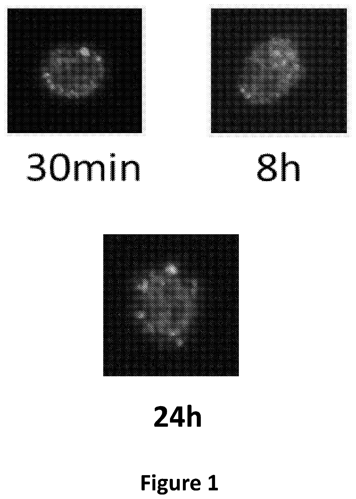 Mitochondrial augmentation therapy for primary mitochondrial diseases