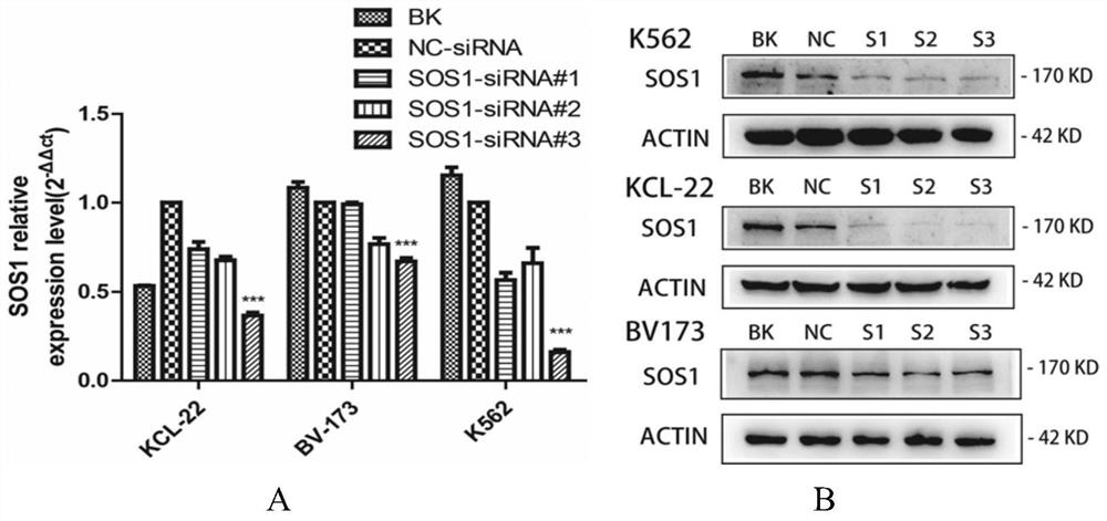 SiRNA for targeted inhibition of SOS1 gene expression and application of siRNA