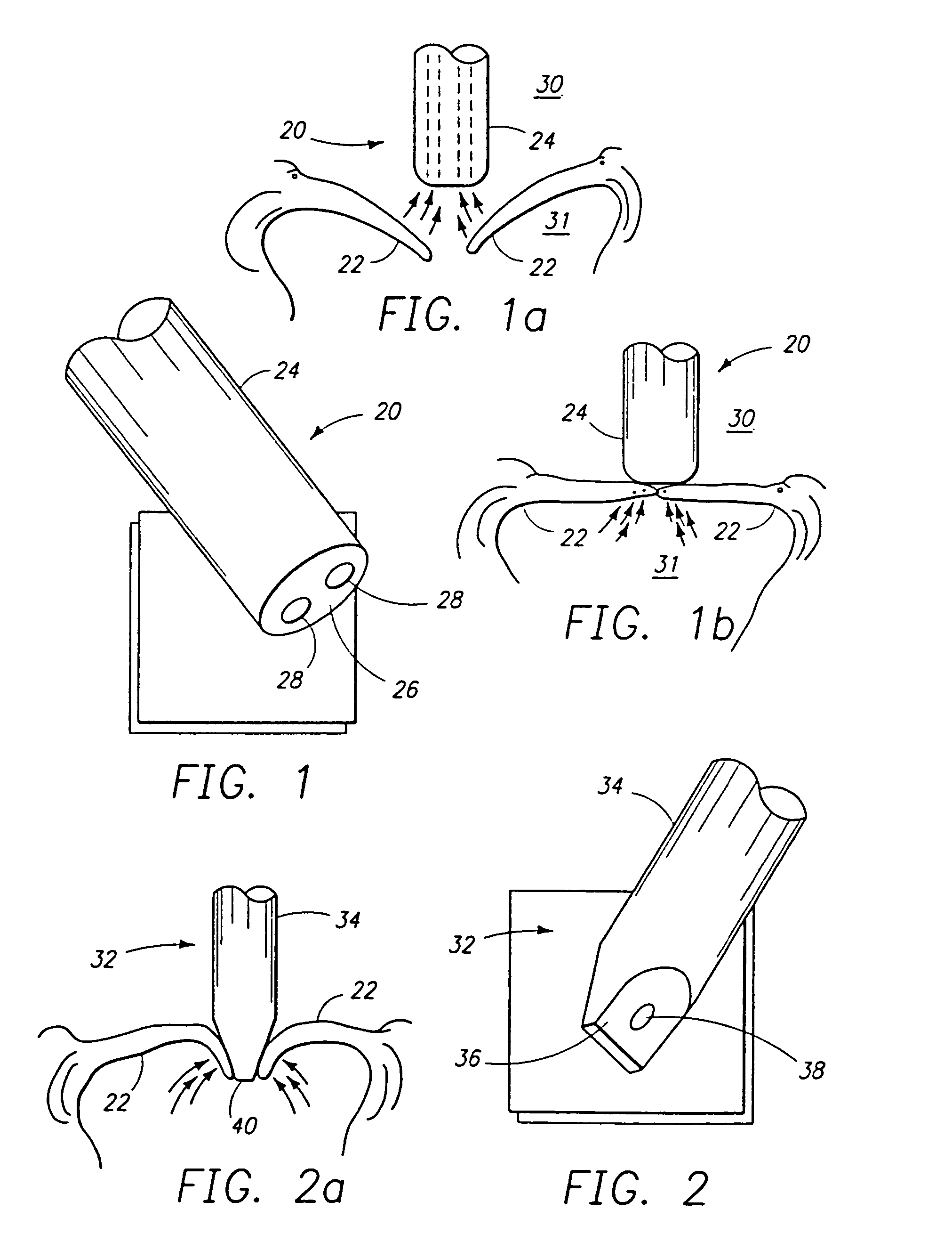 Minimally invasive mitral valve repair method and apparatus