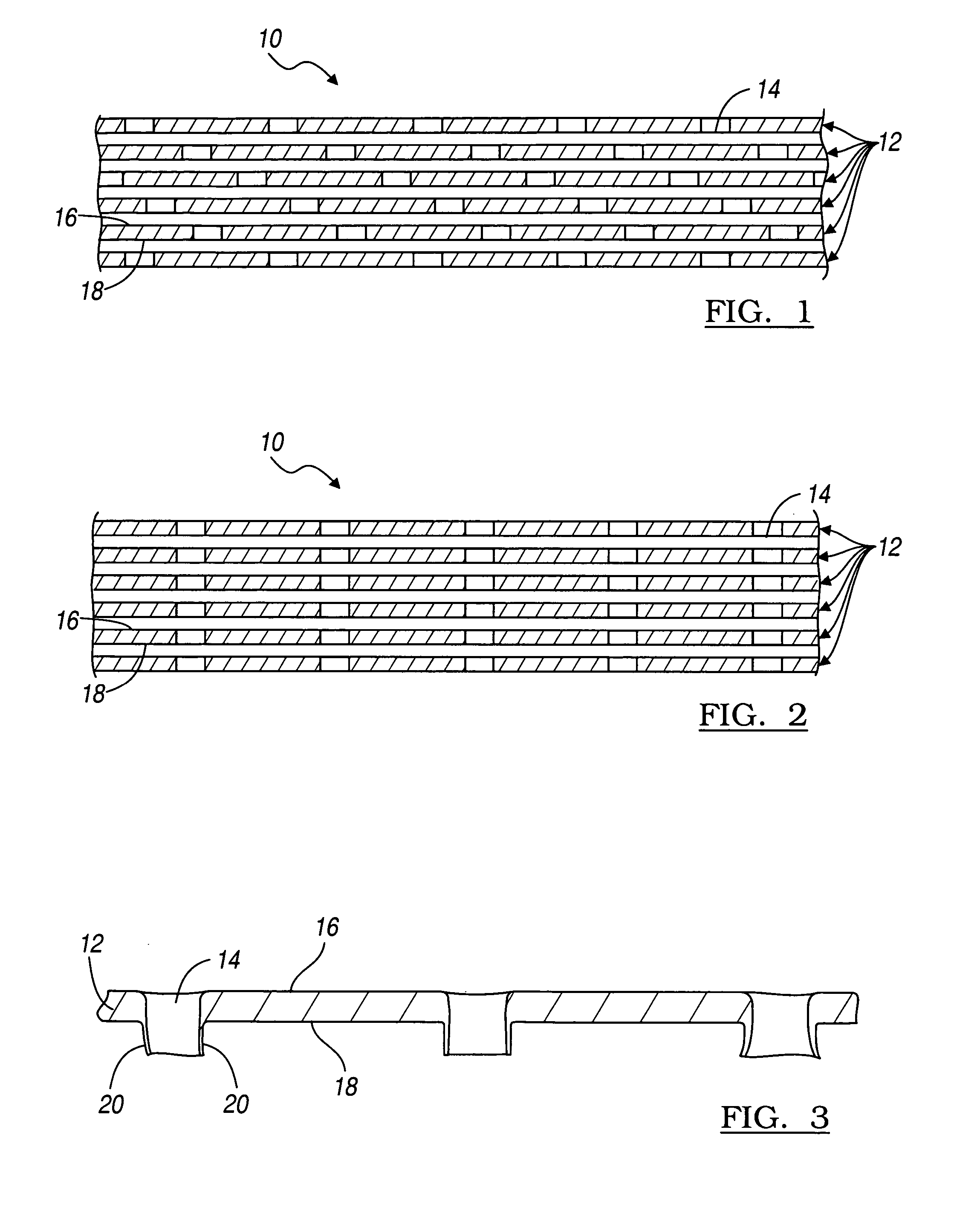 Multilayer microperforated implant
