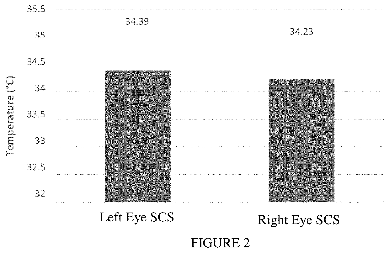 Sustained-release voriconazole-containing thermogel and uses thereof