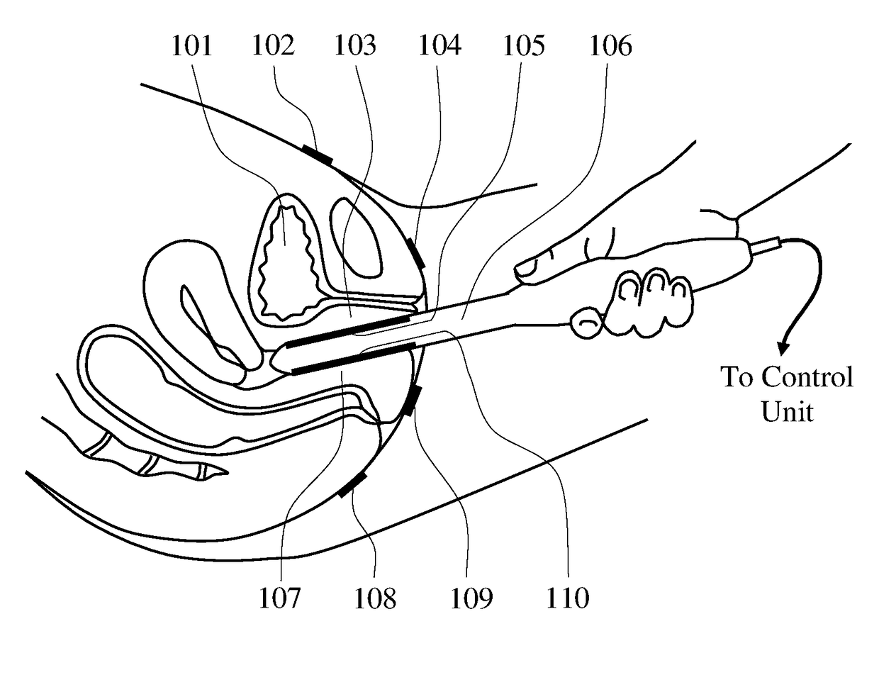 Methods and probes for vaginal tactile and electromyographic imaging and location-guided female pelvic floor therapy