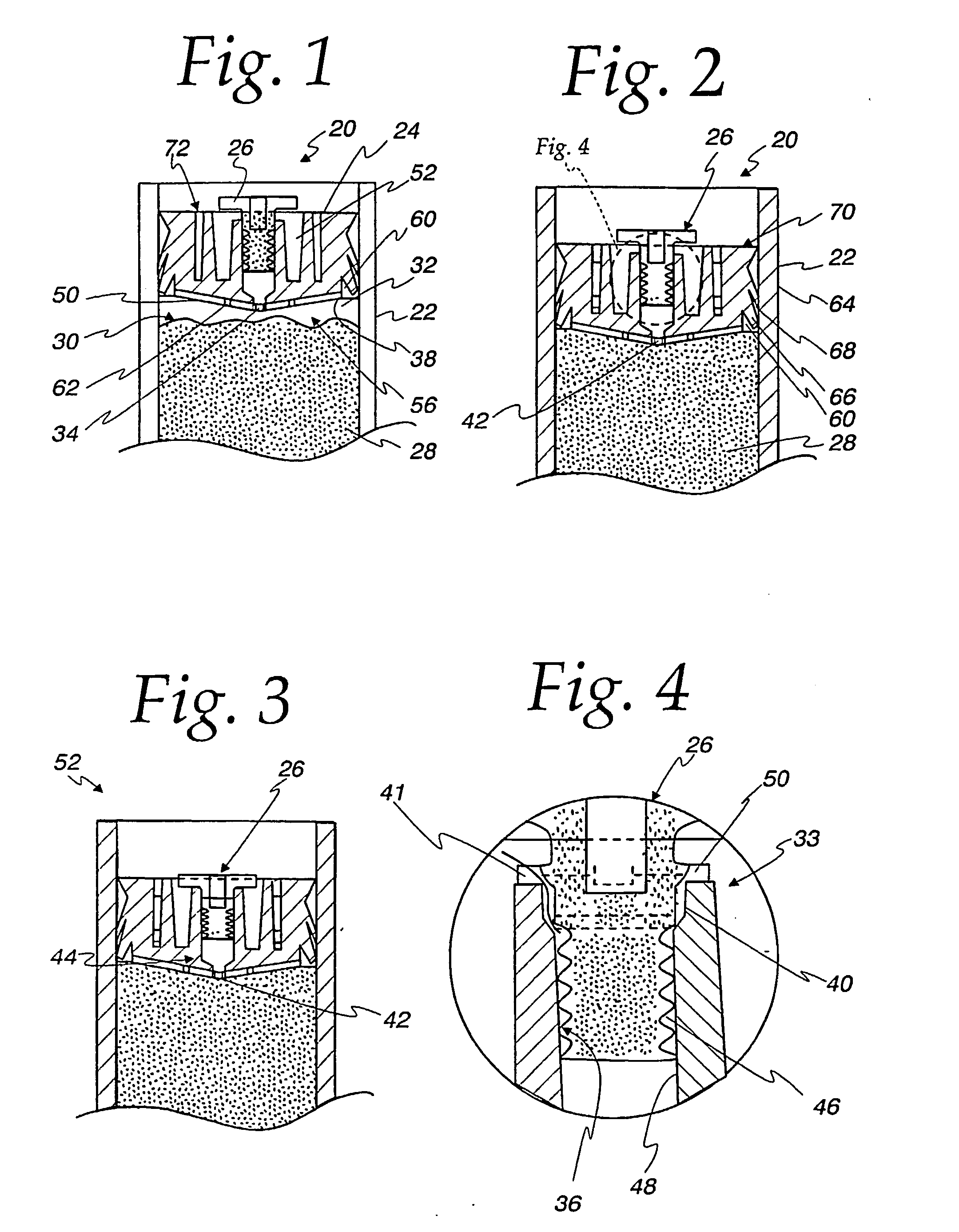 Dispensing cartridge with tortuous vent path