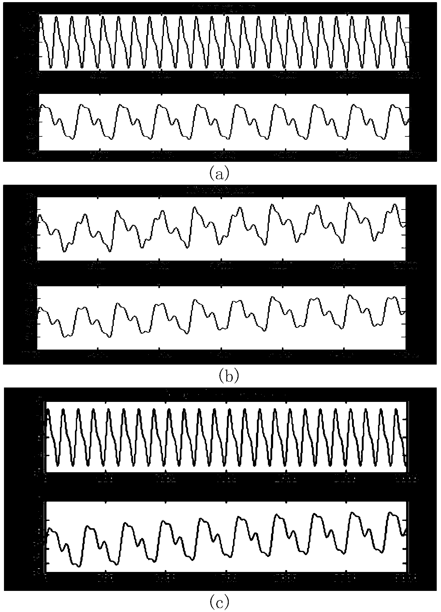 Magnetic induction cardiopulmonary activity signal separation method based on Fast-ICA method