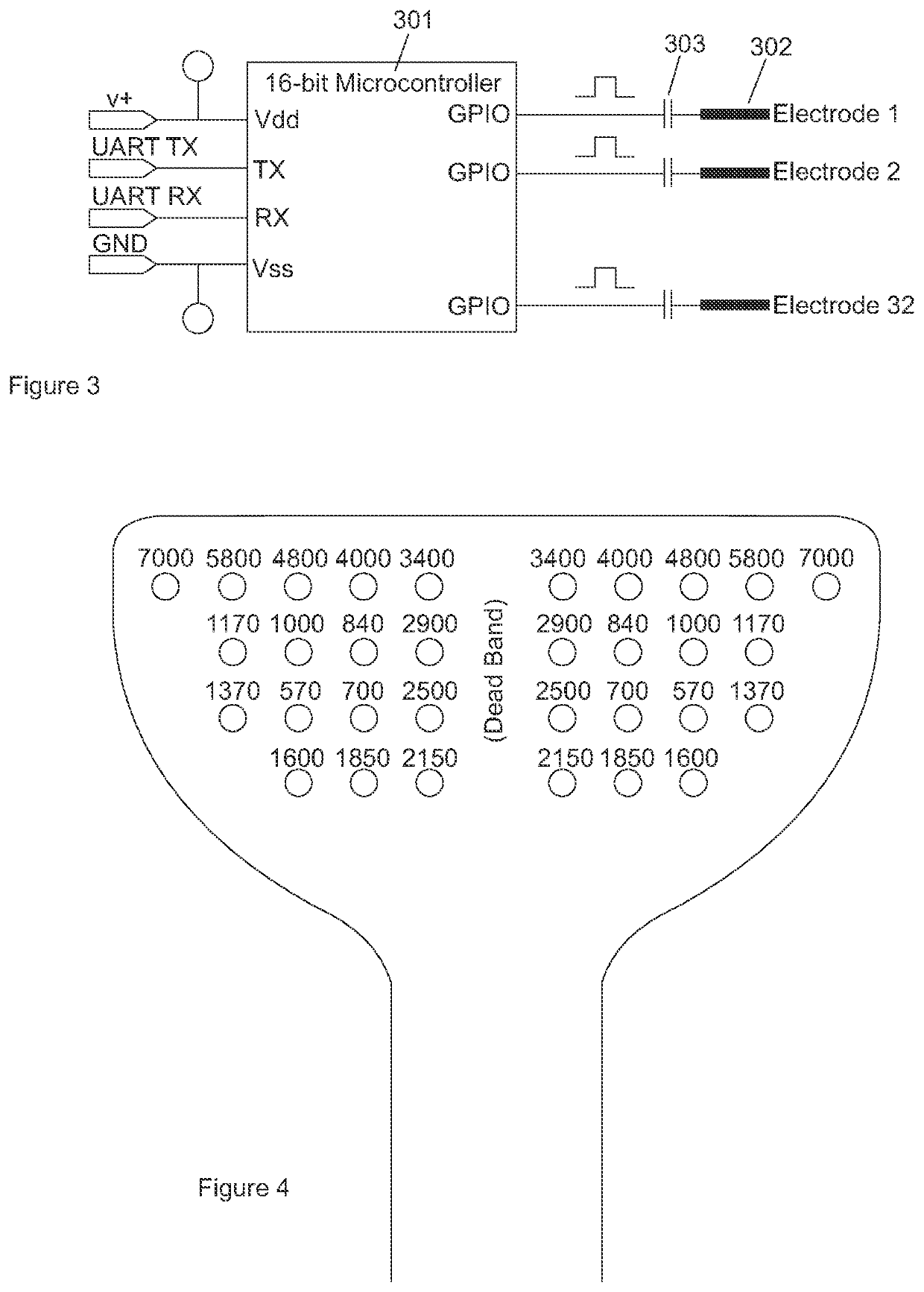 Apparatus and method for treating a neurological disorder of the auditory system