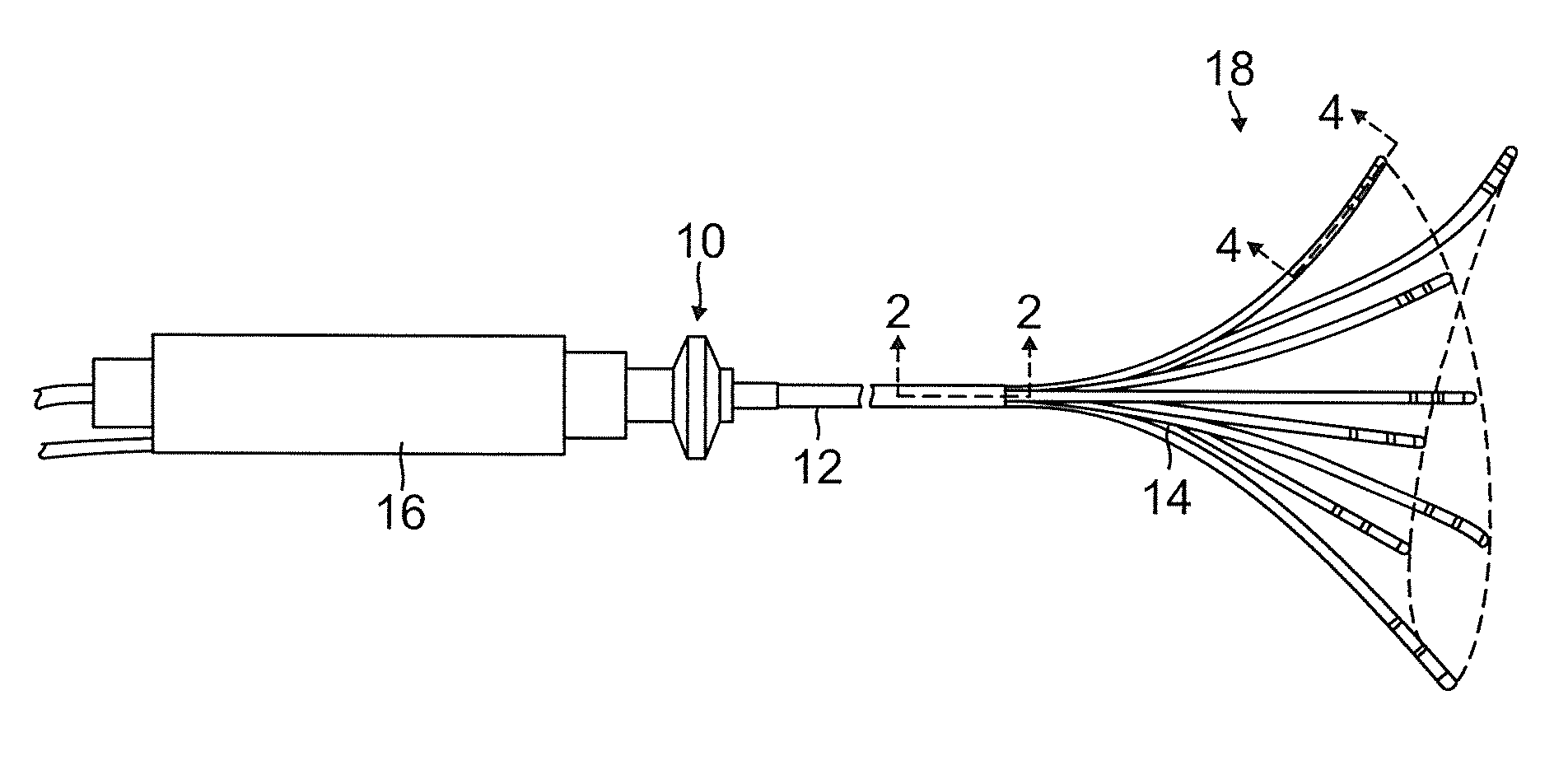 Catheter with multiple spines of different lengths arranged in one or more distal assemblies