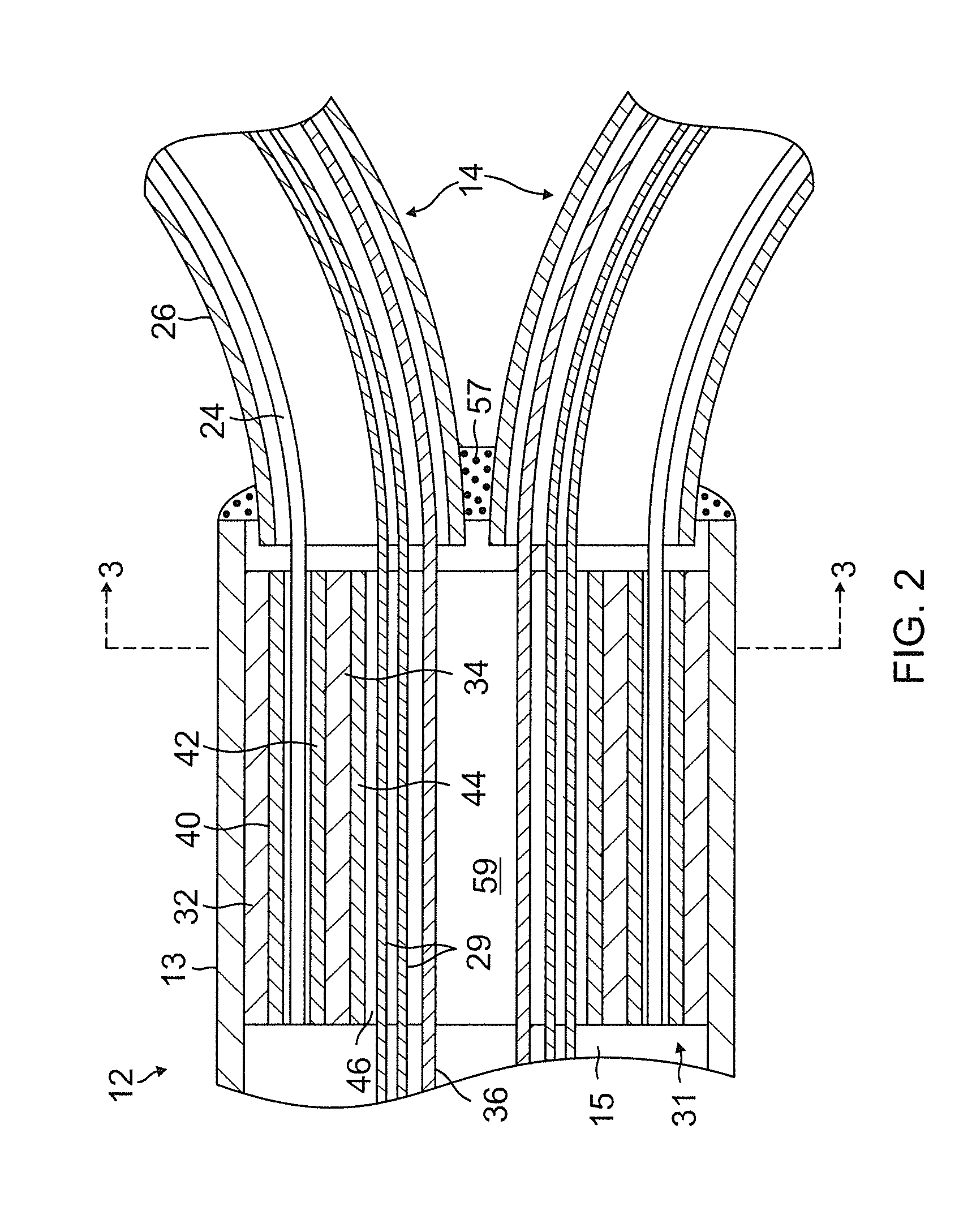 Catheter with multiple spines of different lengths arranged in one or more distal assemblies
