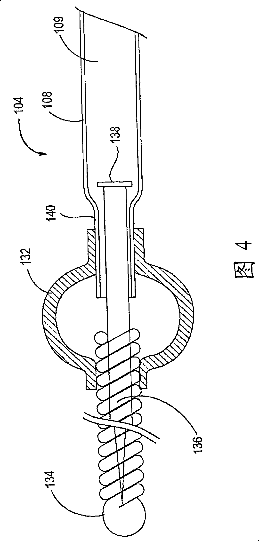 Apparatus and methods for protected angioplasty and stenting at a carotid bifurcation