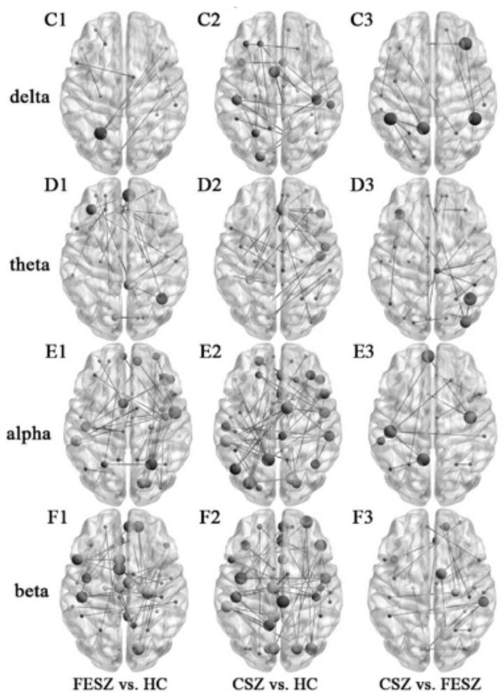 Schizophrenia early detection system based on graph neural network and brain network