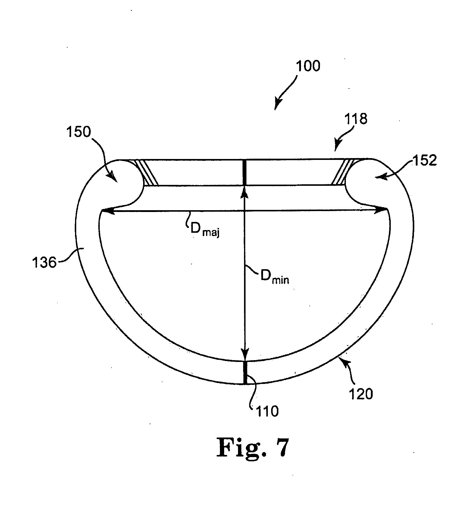 Set of Annuloplasty Devices with Varying Anterior-Posterior Ratios and Related Methods