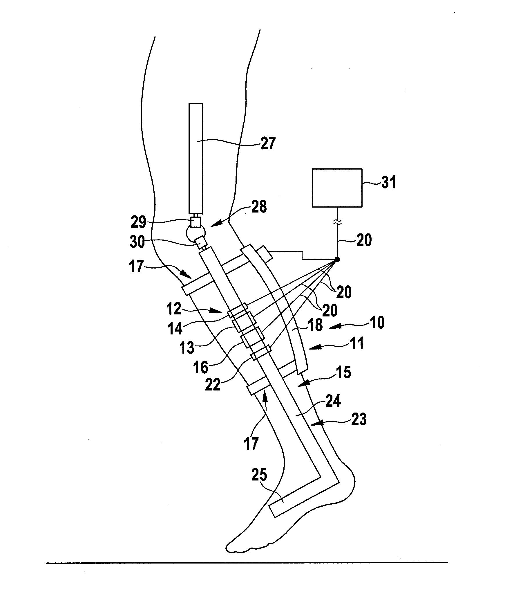 Device and method for electric stimulation of muscles involved in human physiological gait pattern and brace to support an anatomical joint with such device