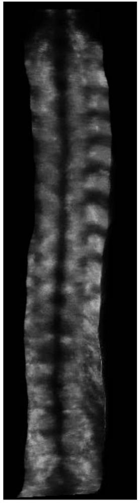 Three-dimensional visualization method based on spine three-dimensional ultrasonic volume data