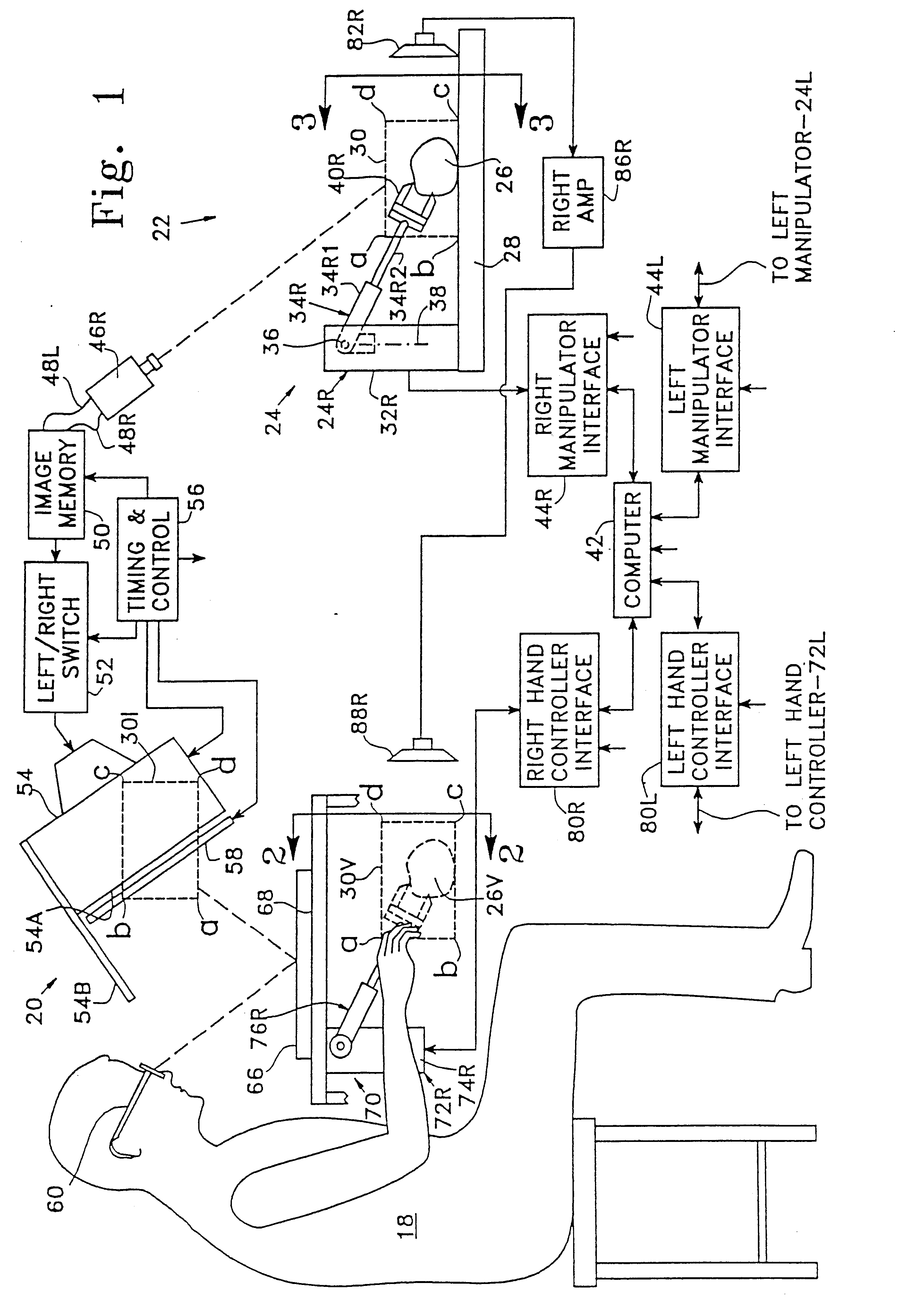 System and method for remote endoscopic surgery