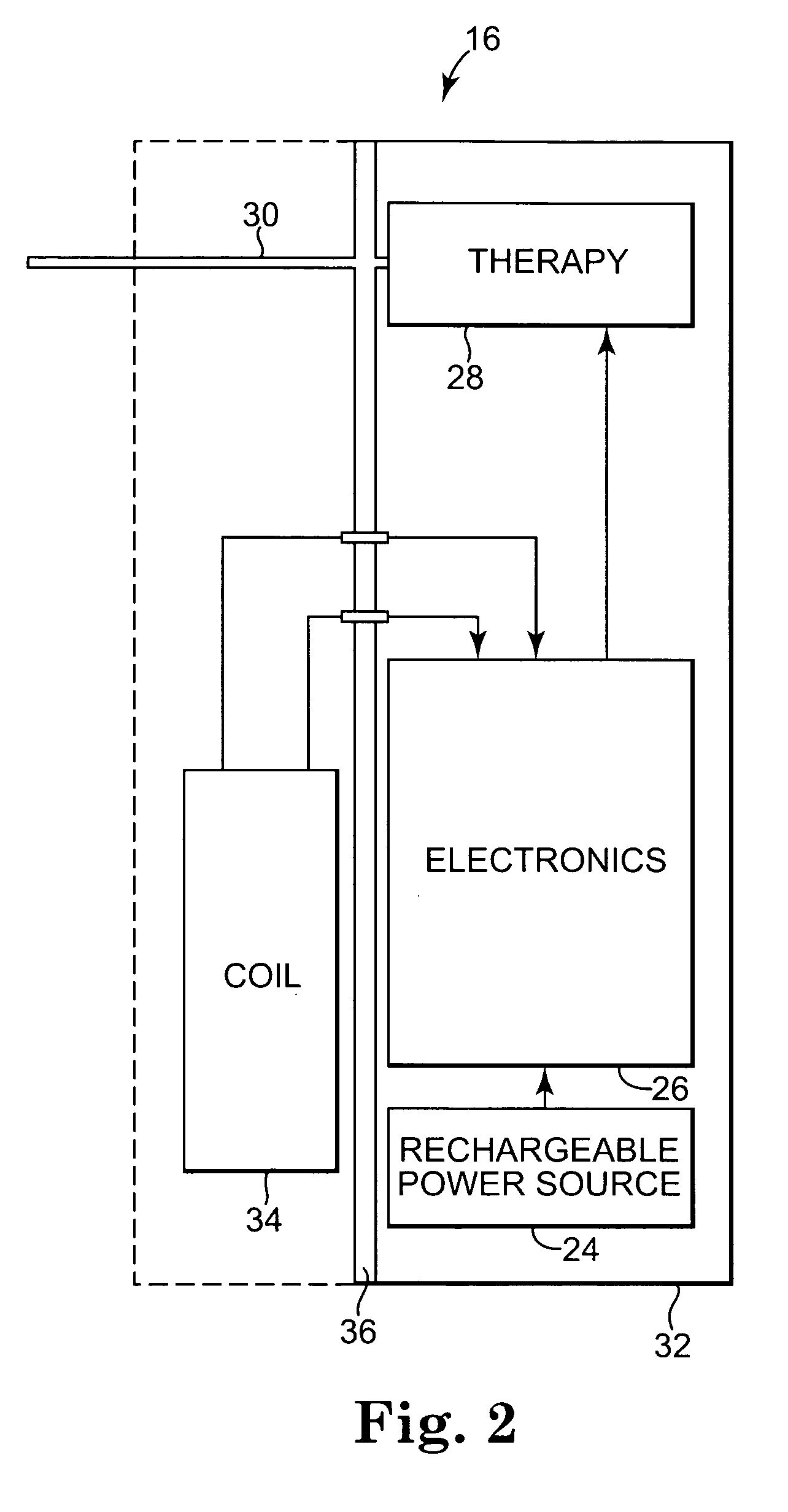 External power source for an implantable medical device having an adjustable magnetic core and system and method related therefore
