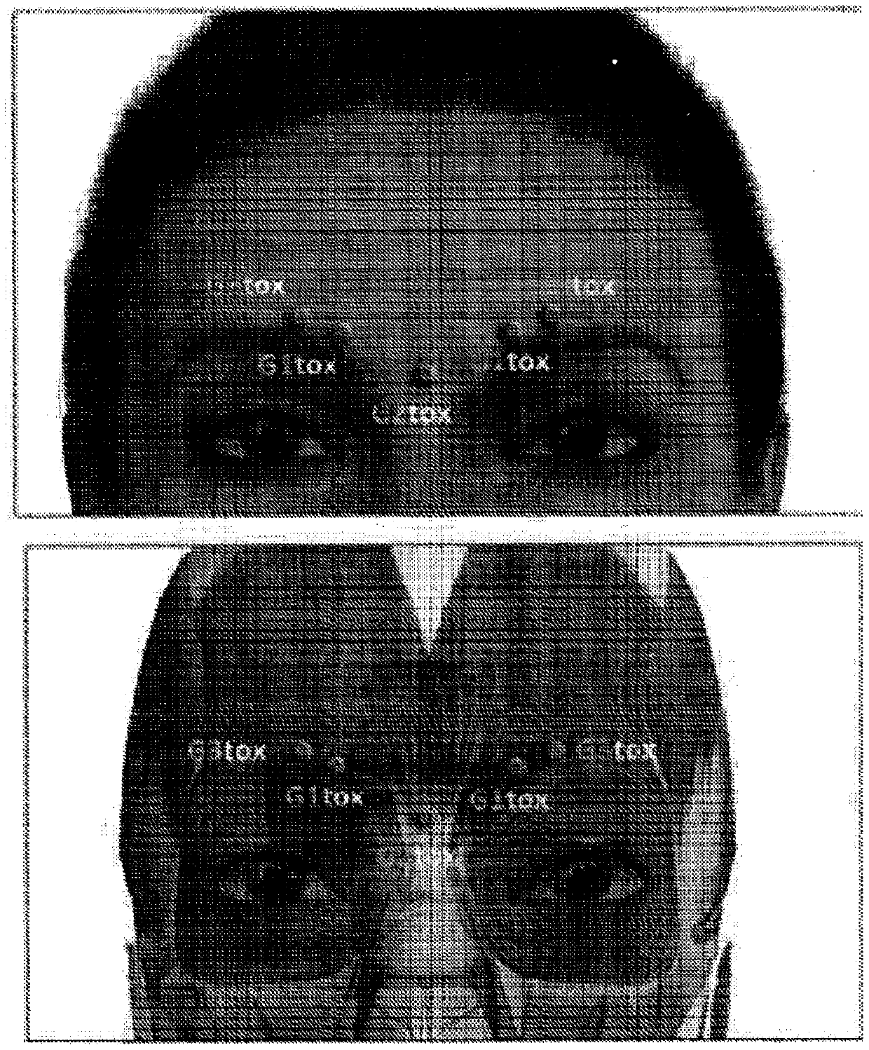 Methods and systems for preventing, correcting, transforming, and modifying facial, aesthetics, and consulting patients regarding the same