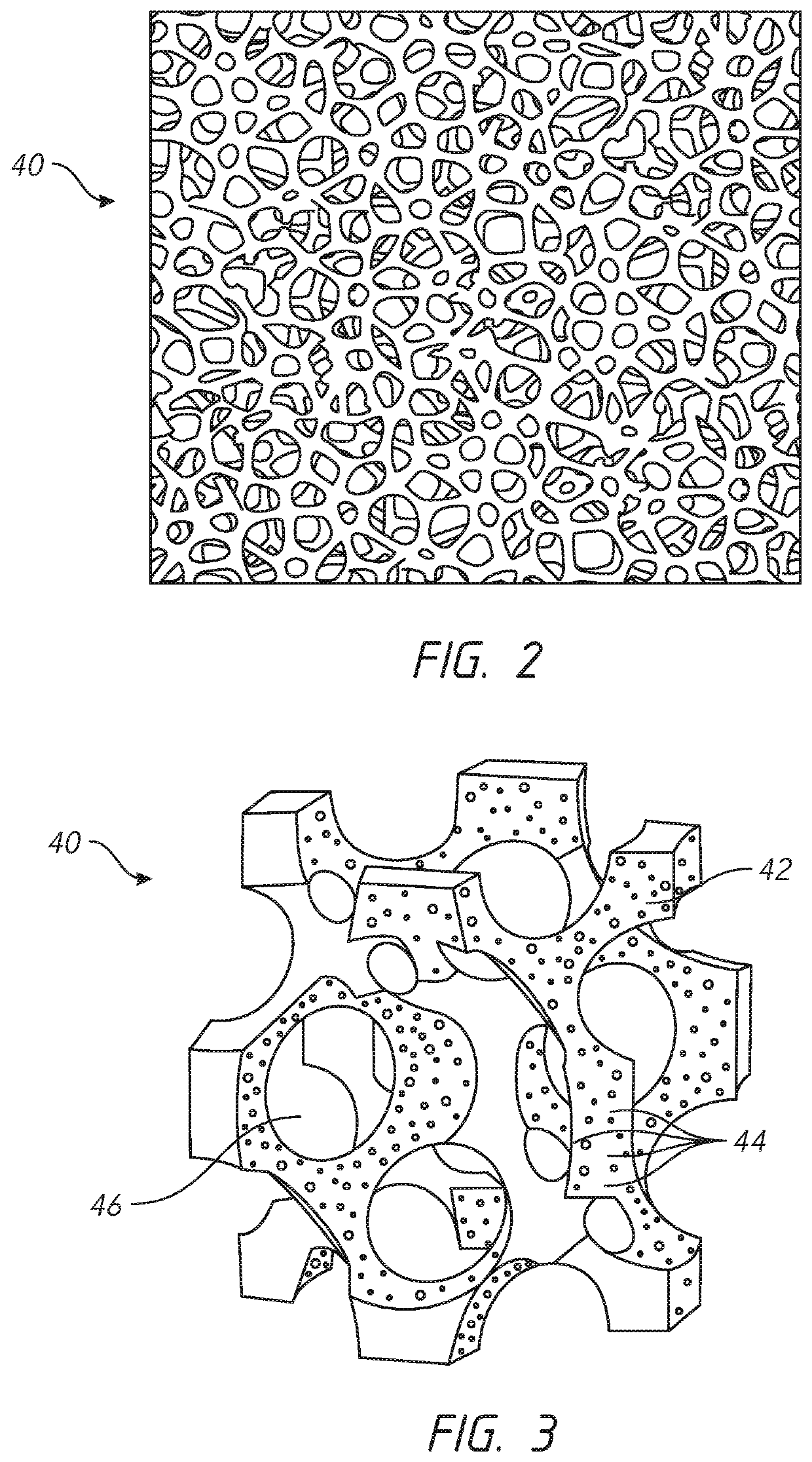 Implantable prostheses for tissue expansion