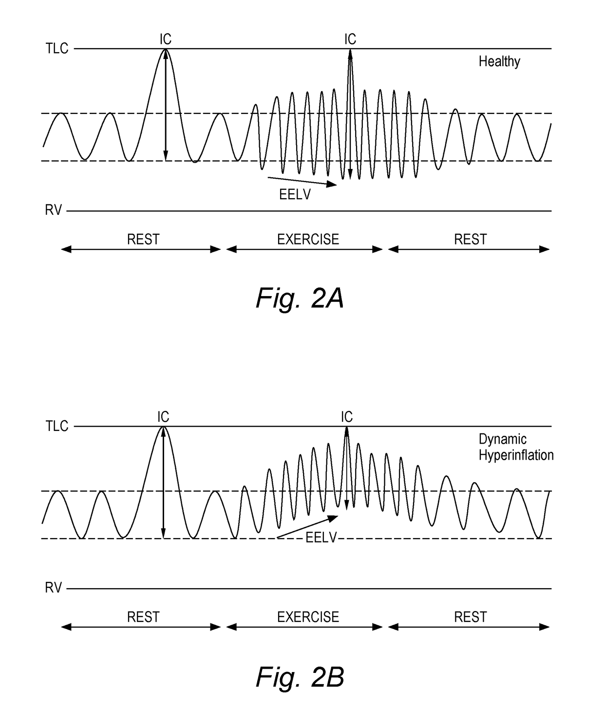 Device and Method for Assessing Respiratory Data in a Monitored Subject