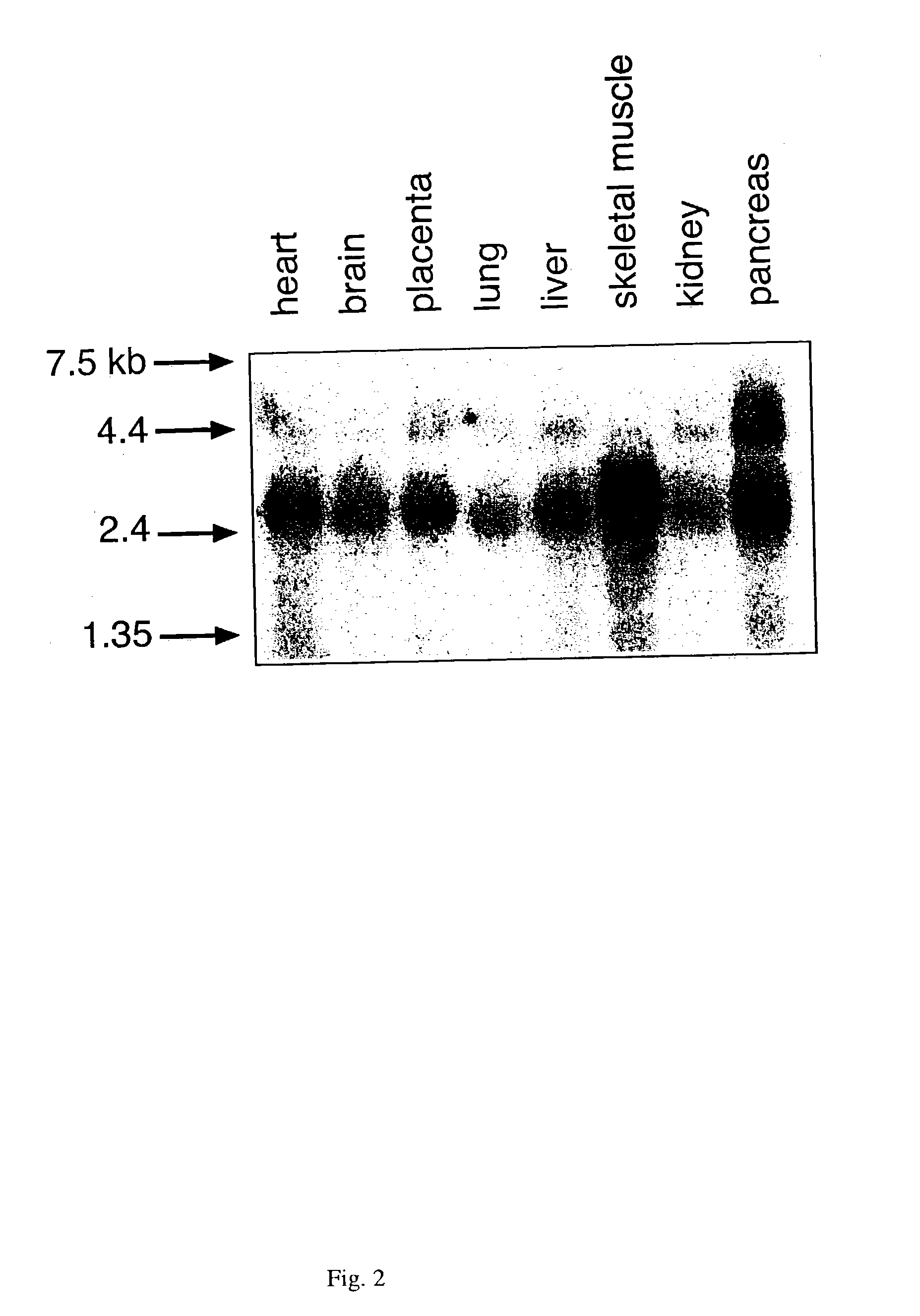 Antibodies immunologically specific for a DNA repair endonuclease and methods of use thereof