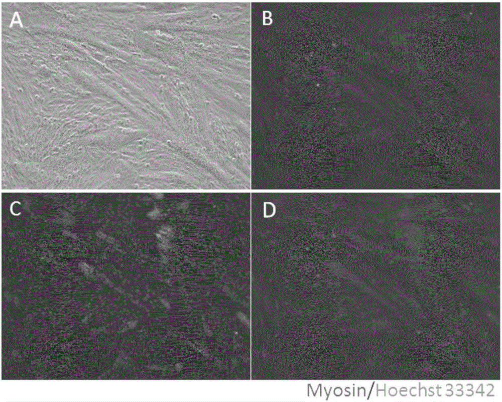 Porcine skeletal muscle satellite cell culture medium PM+ and application thereof
