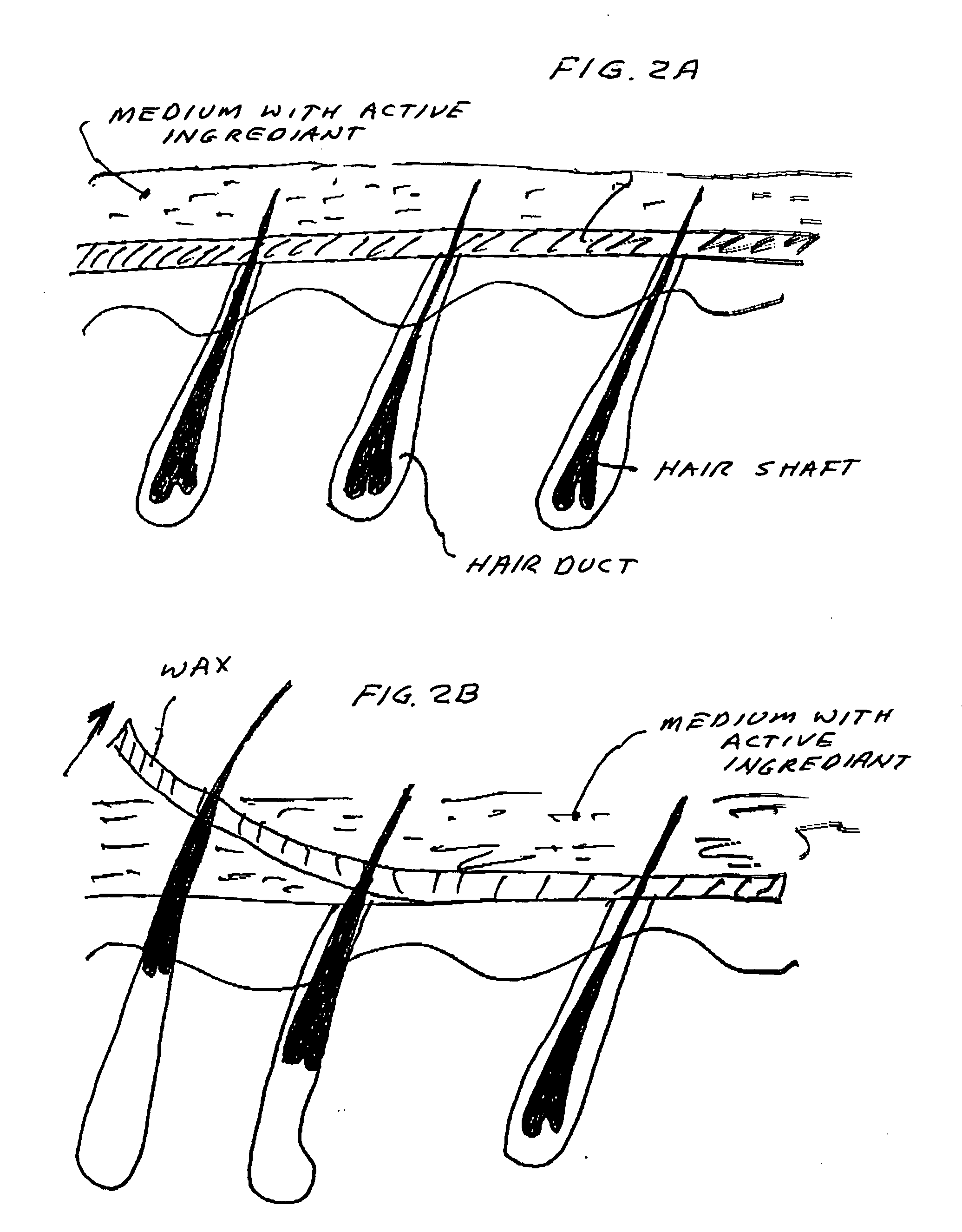 Device and method for hair growth from stem cells