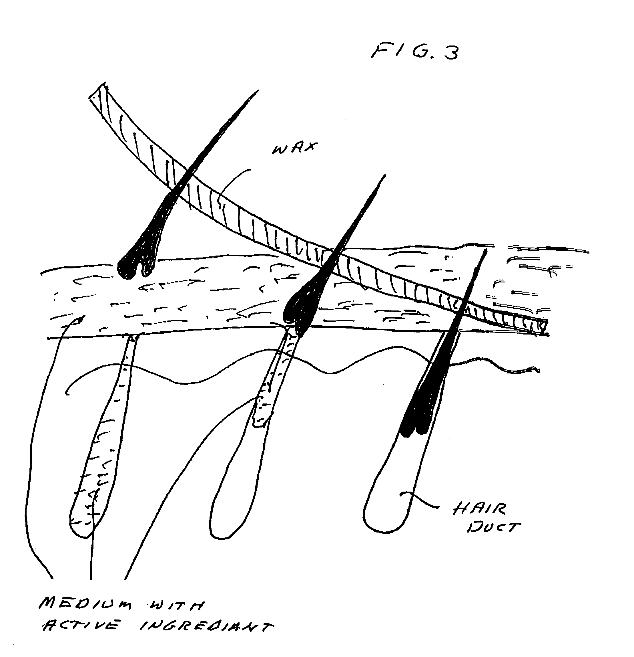 Device and method for hair growth from stem cells