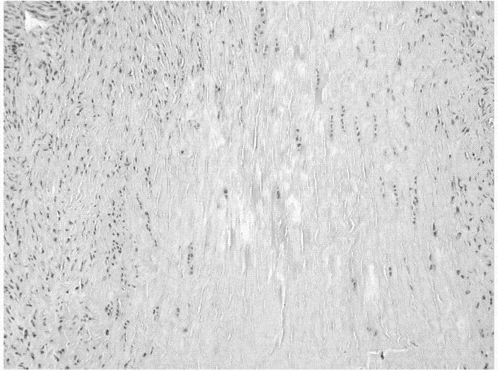 Application of tanshinone II A in preparing medicine for curing tendon adhesion